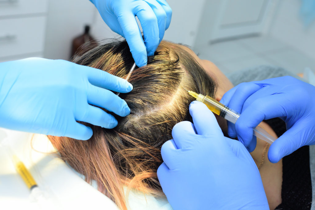 Hair Restoration with Natural Growth Factor Injections | SkyRose Rejuvenation Clinic & Spa | Orland Park, IL