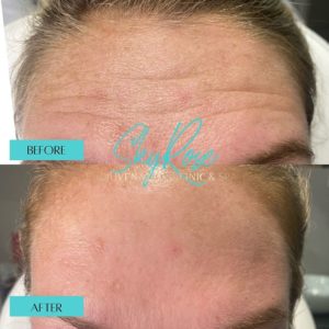 SkyRoseRCS_BeforeAfter | Orland Park, IL