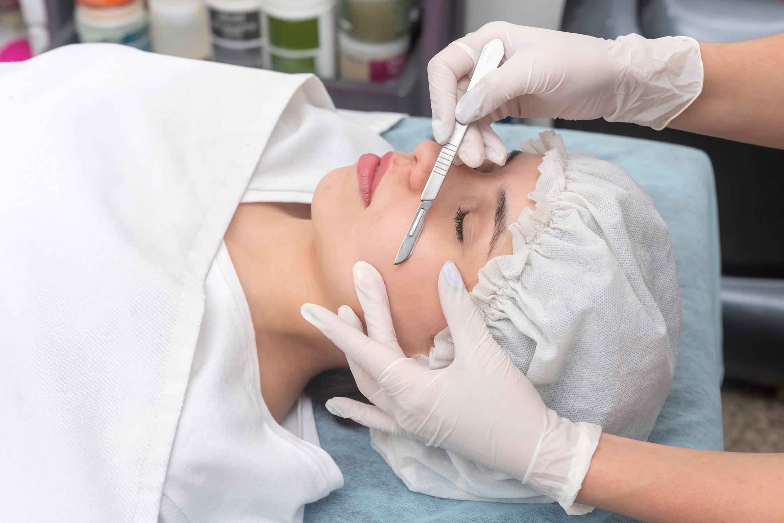 What is Dermaplaning What Are its Benefits
