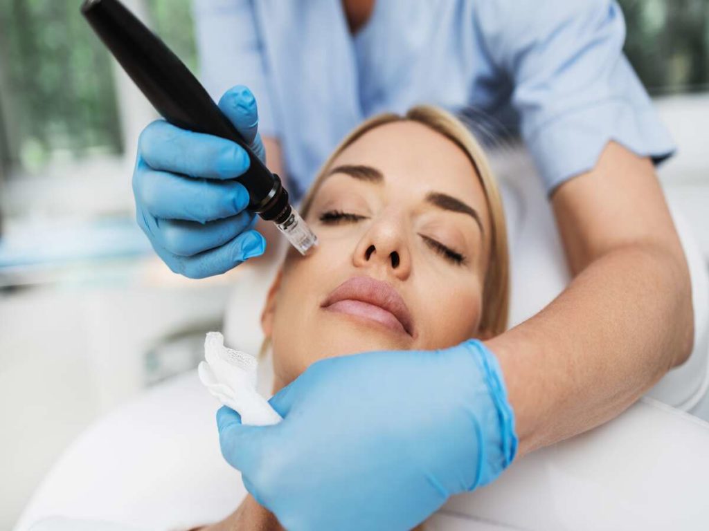Microneedling by SkyRose Rejuvenation Clinic & Spa in ORLAND PARK IL
